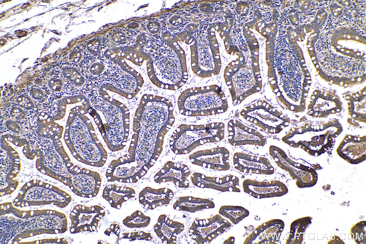Immunohistochemical analysis of paraffin-embedded human small intestine tissue slide using KHC0599 (SLC52A3 IHC Kit).
