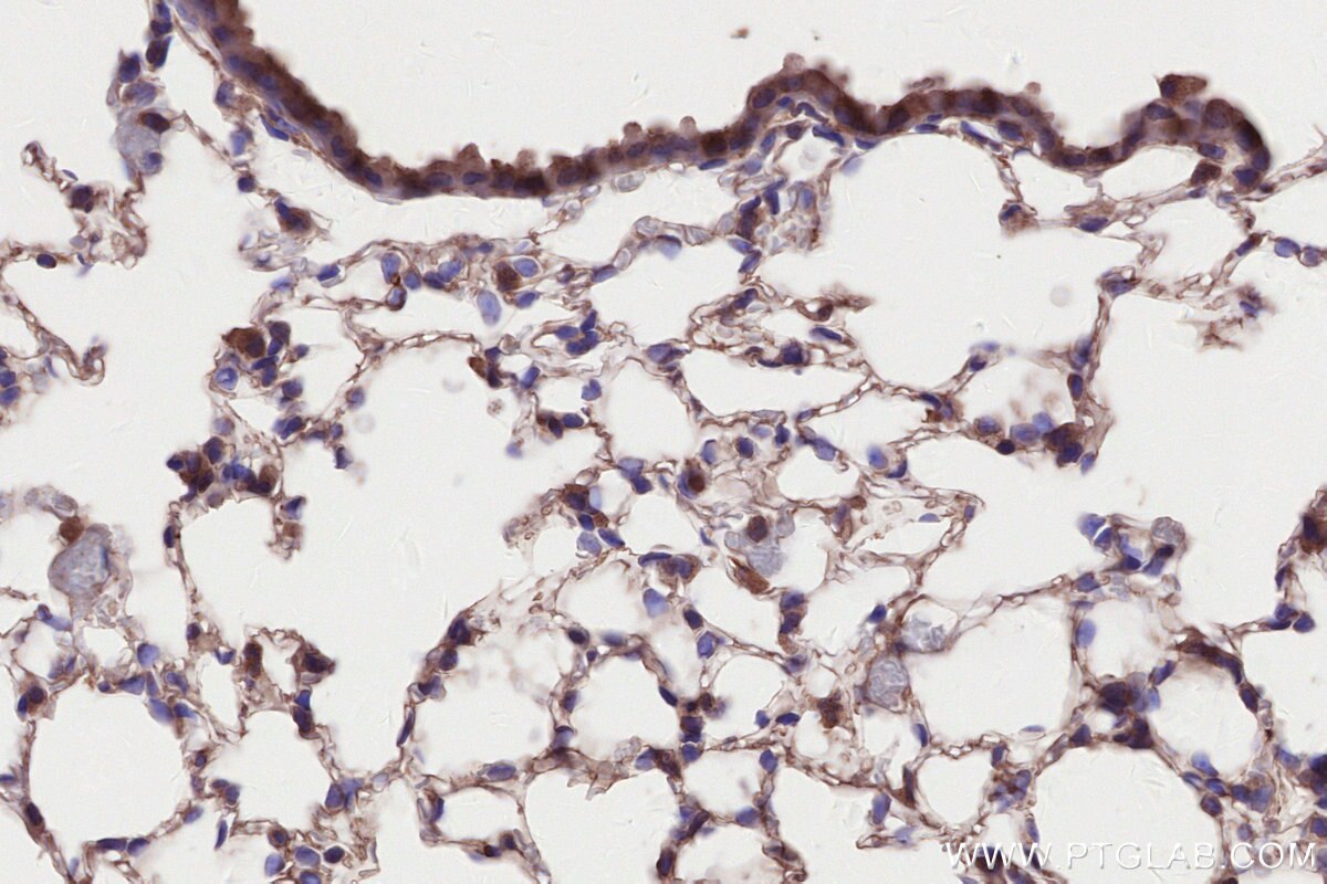 Immunohistochemical analysis of paraffin-embedded mouse lung tissue slide using KHC2641 (C2CD5 IHC Kit).