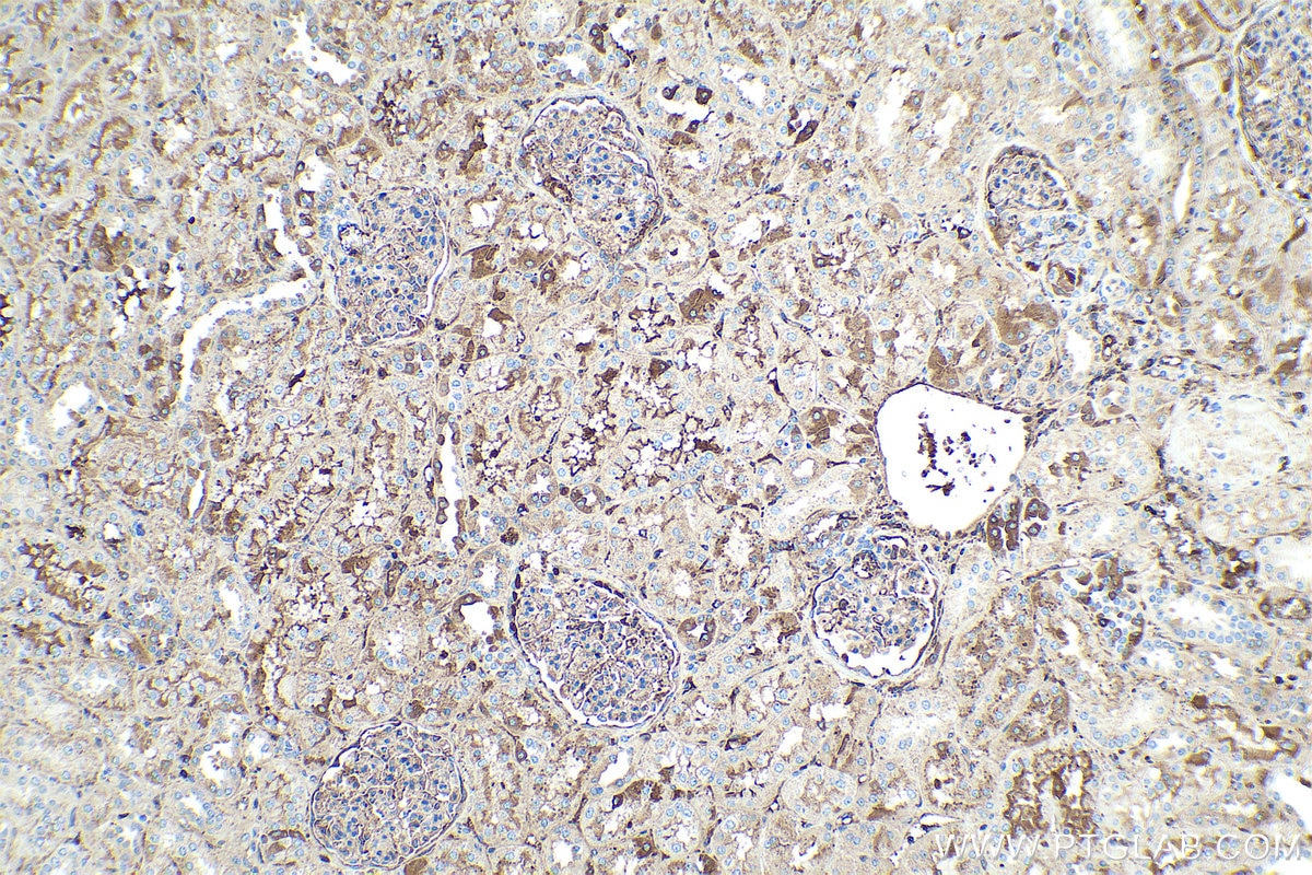 Immunohistochemical analysis of paraffin-embedded human kidney tissue slide using KHC0375 (C3 IHC Kit).