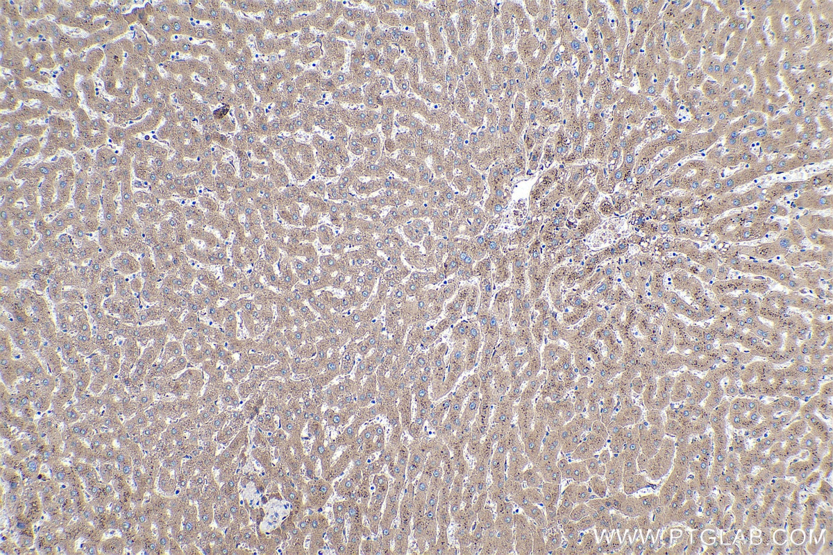 Immunohistochemical analysis of paraffin-embedded human liver tissue slide using KHC0375 (C3 IHC Kit).