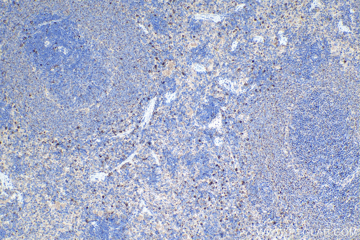 Immunohistochemical analysis of paraffin-embedded rat spleen tissue slide using KHC1293 (C5AR1 IHC Kit).
