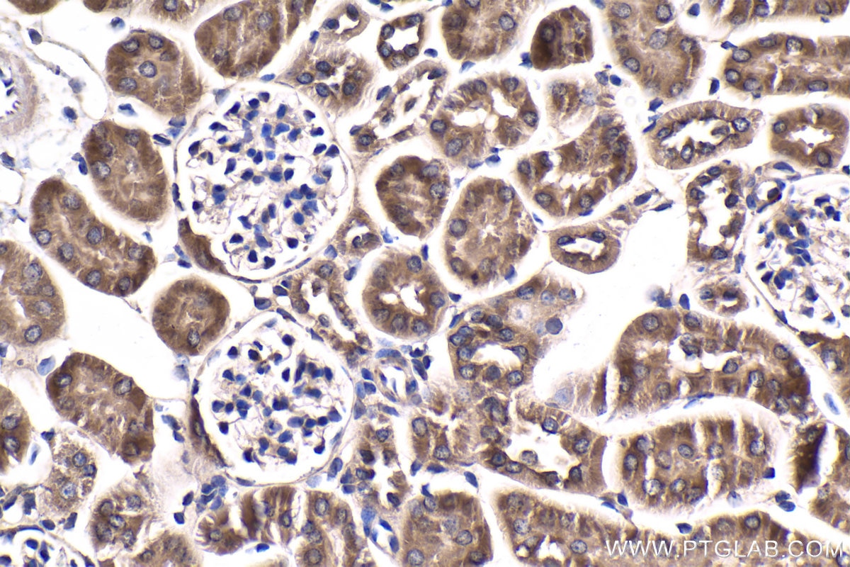 Immunohistochemical analysis of paraffin-embedded mouse kidney tissue slide using KHC1878 (C9orf72 IHC Kit).
