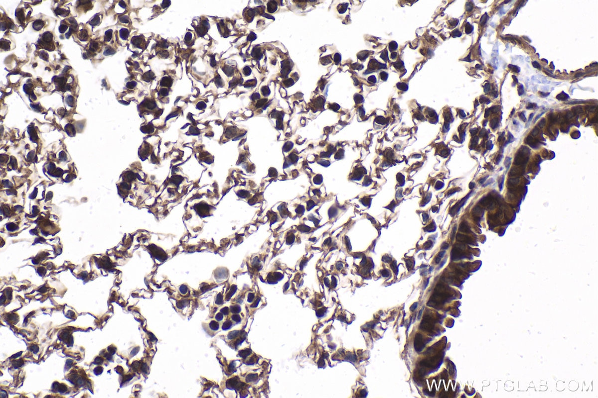 Immunohistochemical analysis of paraffin-embedded mouse lung tissue slide using KHC1878 (C9orf72 IHC Kit).