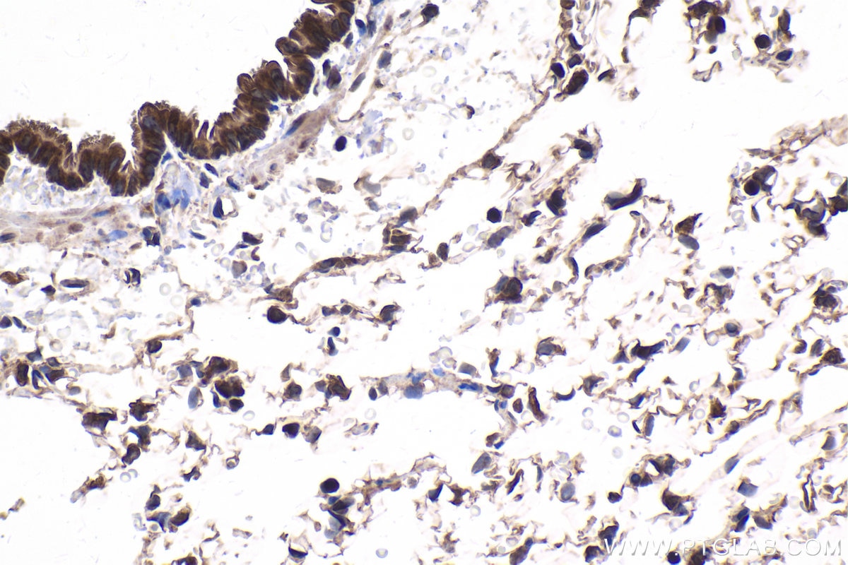 Immunohistochemical analysis of paraffin-embedded rat lung tissue slide using KHC1878 (C9orf72 IHC Kit).