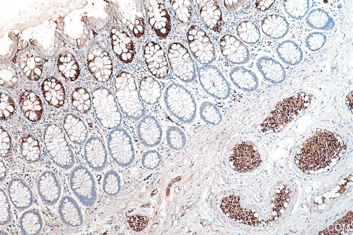 Immunohistochemical analysis of paraffin-embedded human colon tissue slide using KHC0551 (CA1 IHC Kit).