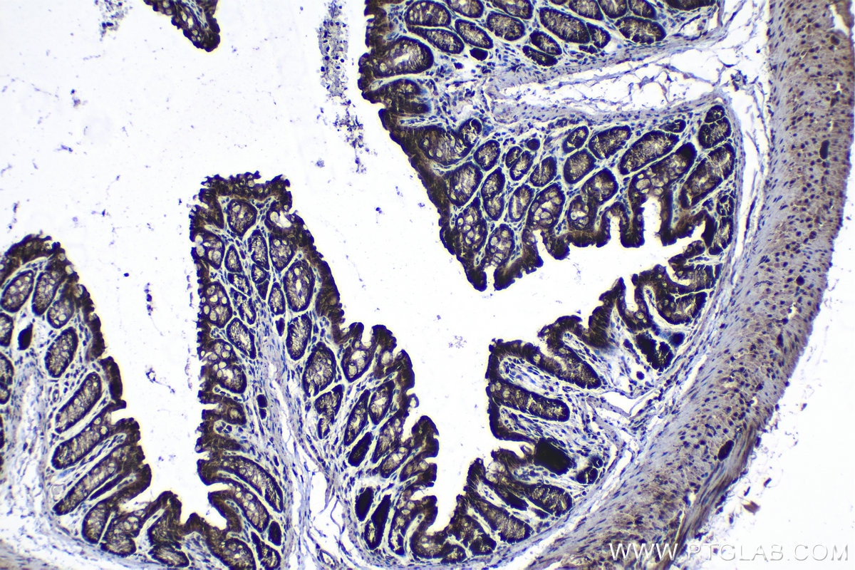 Immunohistochemical analysis of paraffin-embedded mouse colon tissue slide using KHC1271 (CAB39L IHC Kit).