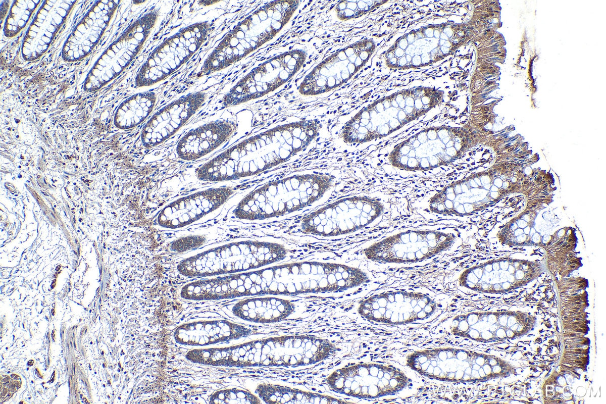 Immunohistochemical analysis of paraffin-embedded human colon tissue slide using KHC1271 (CAB39L IHC Kit).