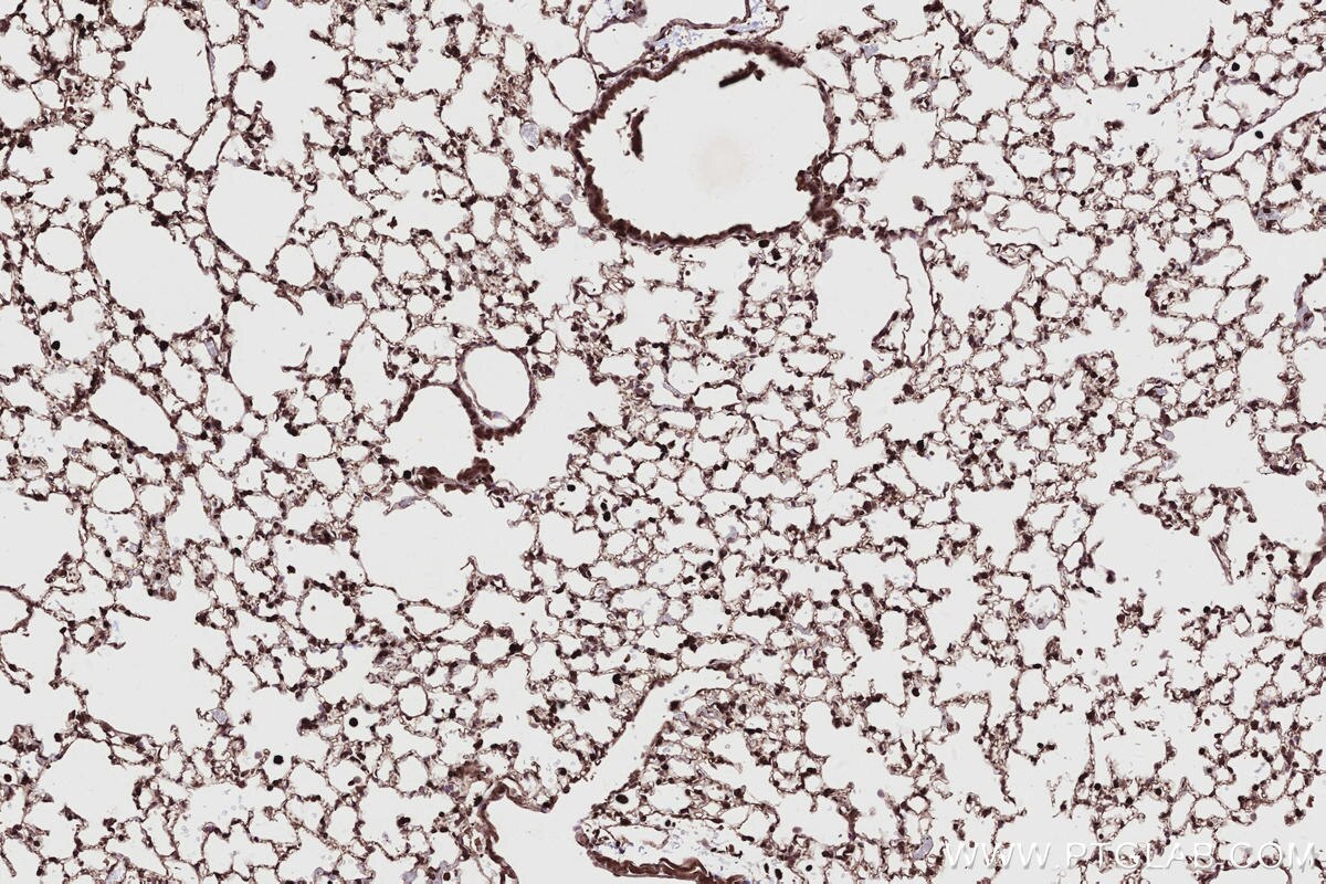 Immunohistochemical analysis of paraffin-embedded mouse lung tissue slide using KHC2719 (CABLES1 IHC Kit).