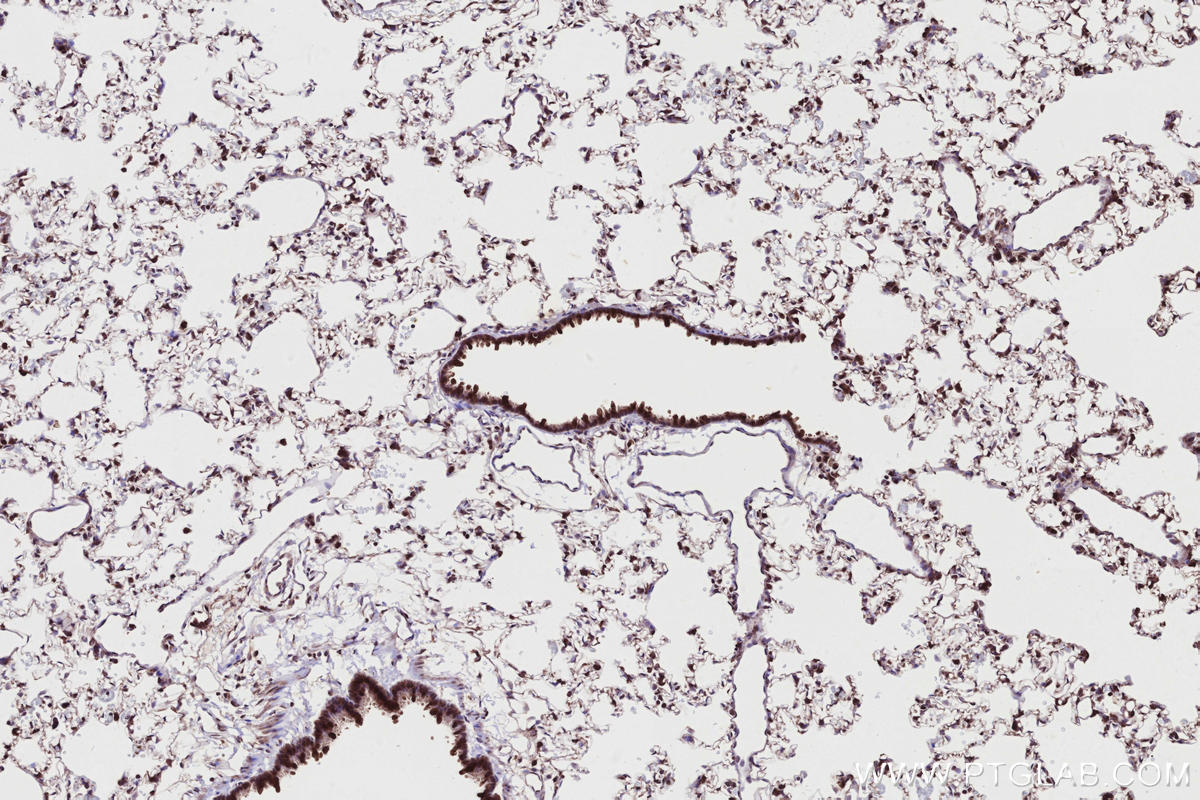 Immunohistochemical analysis of paraffin-embedded rat lung tissue slide using KHC2719 (CABLES1 IHC Kit).