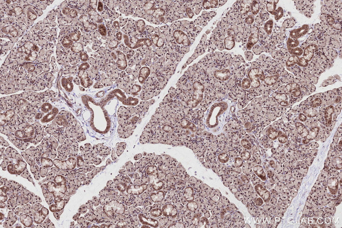 Immunohistochemical analysis of paraffin-embedded rat salivary gland tissue slide using KHC2719 (CABLES1 IHC Kit).