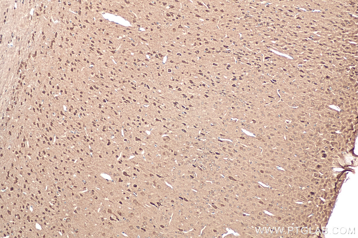 Immunohistochemical analysis of paraffin-embedded mouse brain tissue slide using KHC0868 (CACYBP IHC Kit).