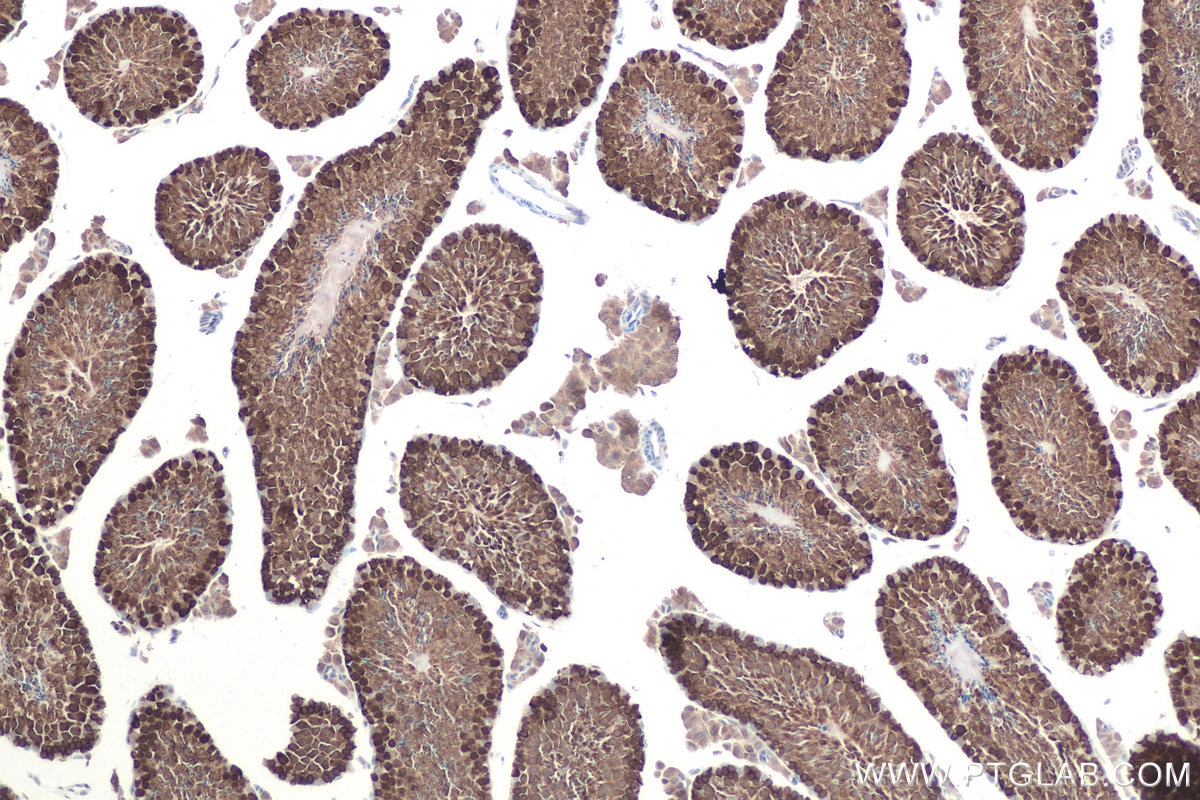 Immunohistochemical analysis of paraffin-embedded mouse testis tissue slide using KHC0868 (CACYBP IHC Kit).