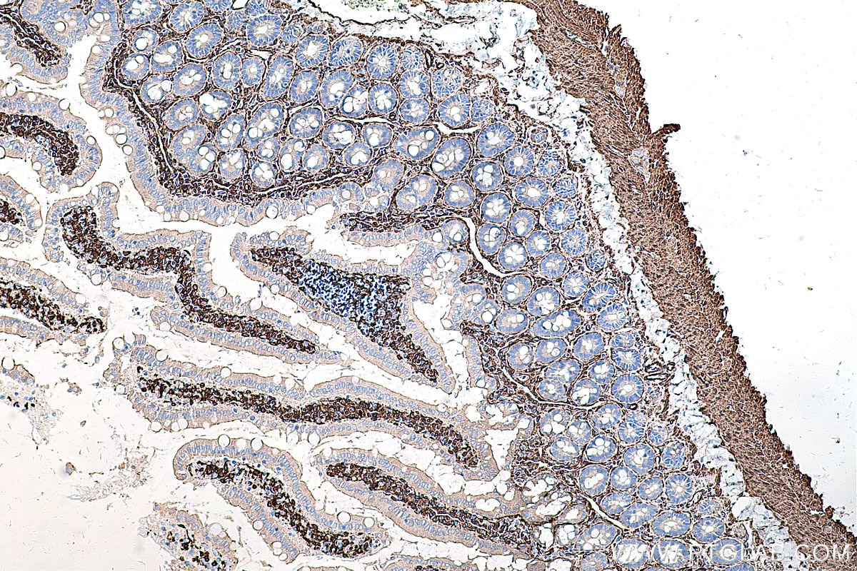 Immunohistochemical analysis of paraffin-embedded rat small intestine tissue slide using KHC0274 (CALD1 IHC Kit).