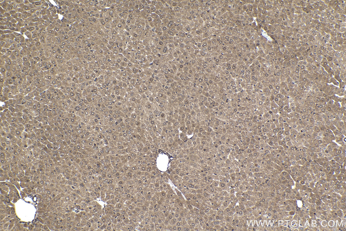 Immunohistochemical analysis of paraffin-embedded mouse liver tissue slide using KHC1724 (CAMK1 IHC Kit).