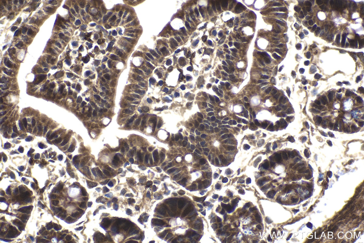 Immunohistochemical analysis of paraffin-embedded mouse small intestine tissue slide using KHC1724 (CAMK1 IHC Kit).