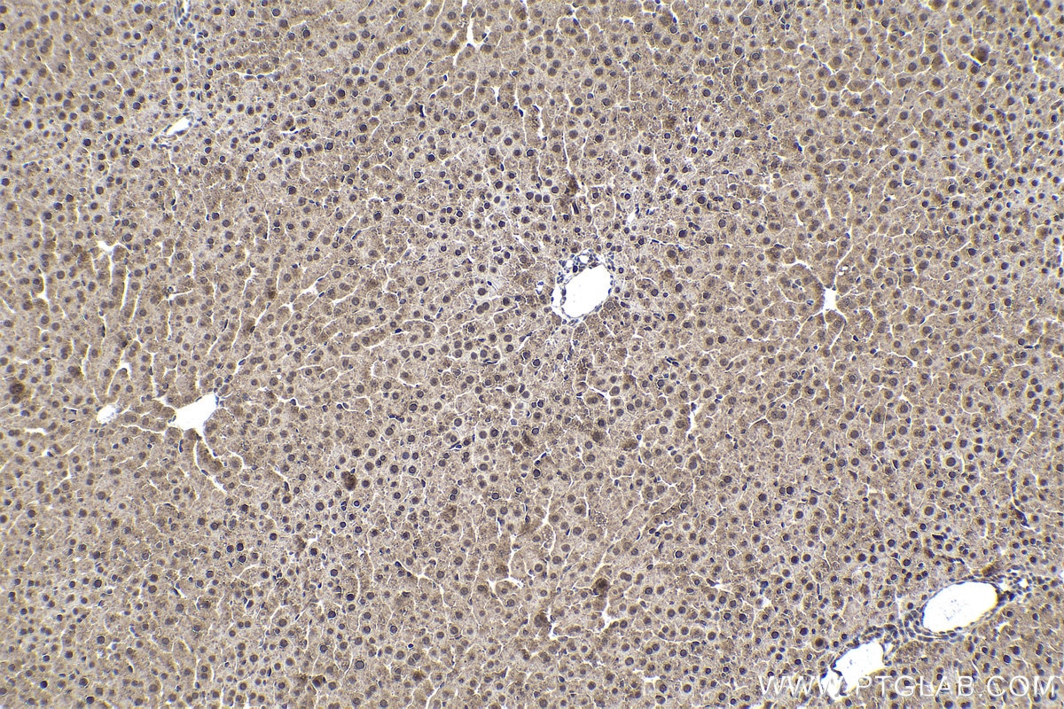 Immunohistochemical analysis of paraffin-embedded rat liver tissue slide using KHC1724 (CAMK1 IHC Kit).