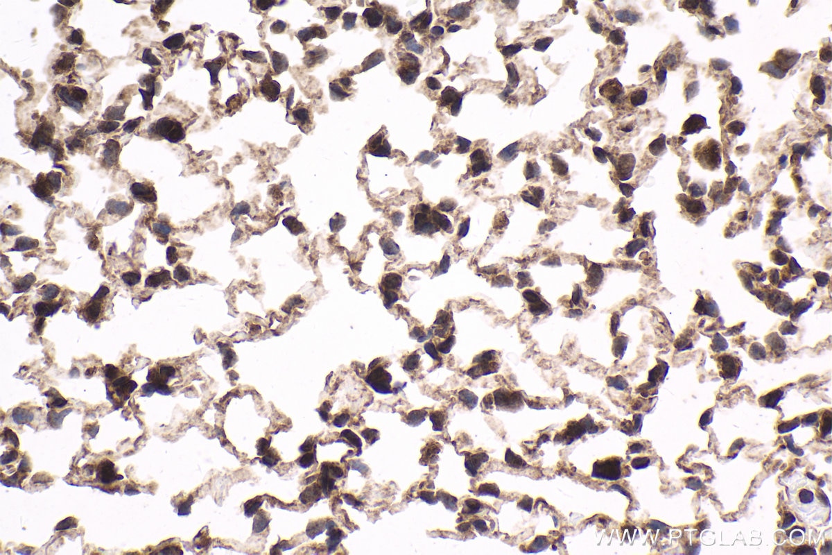 Immunohistochemical analysis of paraffin-embedded mouse lung tissue slide using KHC1816 (CAMK1D IHC Kit).