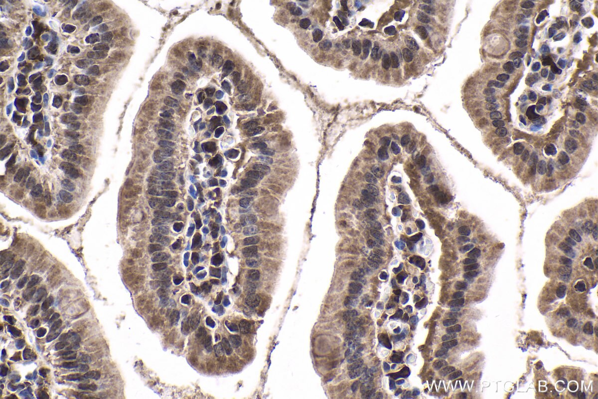 Immunohistochemical analysis of paraffin-embedded mouse small intestine tissue slide using KHC1816 (CAMK1D IHC Kit).