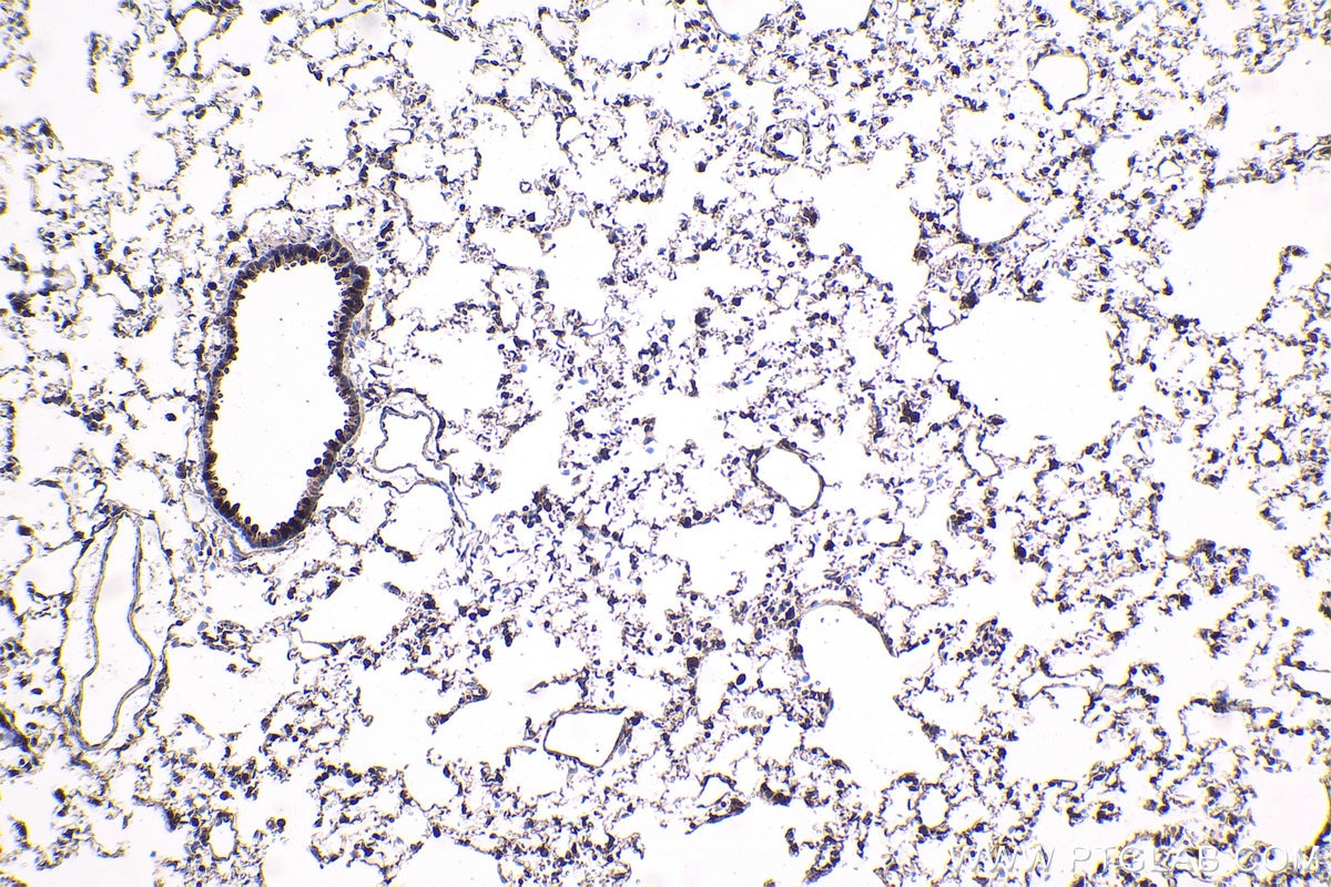Immunohistochemical analysis of paraffin-embedded rat lung tissue slide using KHC1816 (CAMK1D IHC Kit).