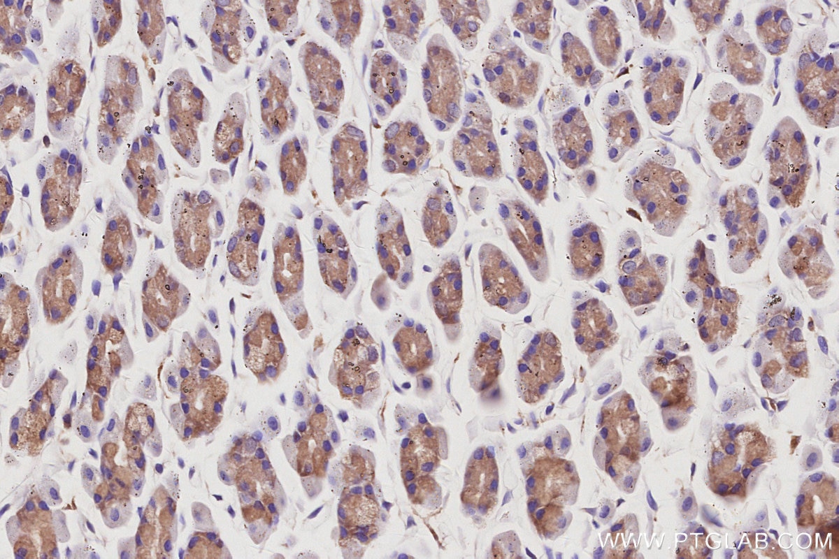 Immunohistochemical analysis of paraffin-embedded rat stomach tissue slide using KHC3050 (CAMK2A IHC Kit). Immunohistochemical analysis of paraffin-embedded rat stomach tissue slide using KHC3050 (CAMK2A IHC Kit).