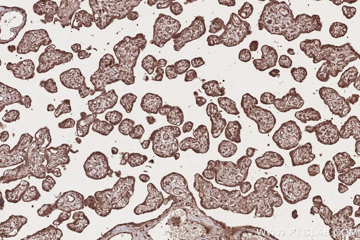 Immunohistochemical analysis of paraffin-embedded human placenta tissue slide using KHC2677 (CAMKK1 IHC Kit).