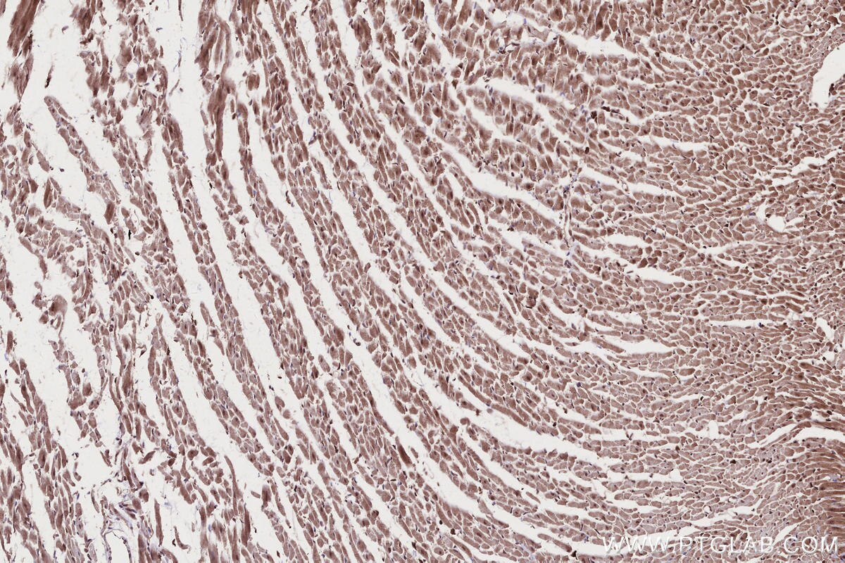 Immunohistochemical analysis of paraffin-embedded rat heart tissue slide using KHC2677 (CAMKK1 IHC Kit).