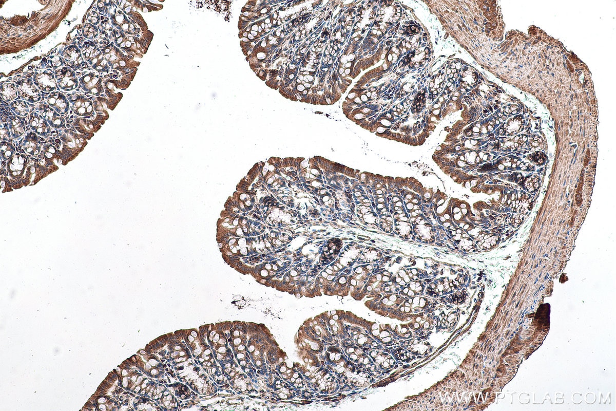 Immunohistochemical analysis of paraffin-embedded mouse colon tissue slide using KHC0969 (CAP2 IHC Kit).