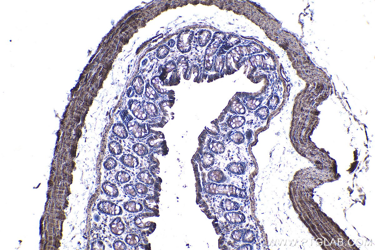 Immunohistochemical analysis of paraffin-embedded rat colon tissue slide using KHC0969 (CAP2 IHC Kit).