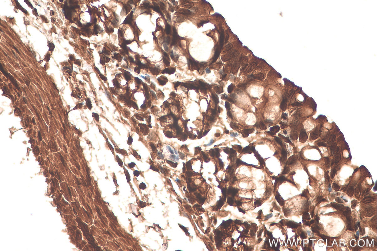 Immunohistochemical analysis of paraffin-embedded mouse colon tissue slide using KHC0709 (CAPG IHC Kit).