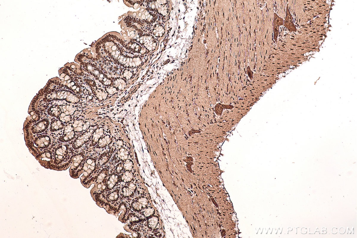 Immunohistochemical analysis of paraffin-embedded rat colon tissue slide using KHC0709 (CAPG IHC Kit).