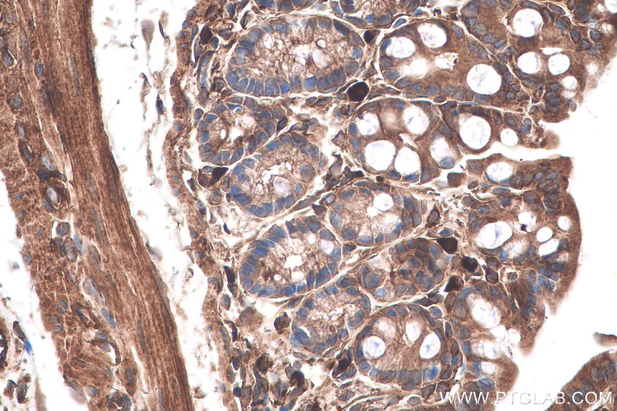 Immunohistochemical analysis of paraffin-embedded mouse colon tissue slide using KHC0724 (CAPN2 IHC Kit).