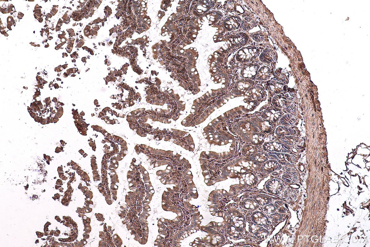 Immunohistochemical analysis of paraffin-embedded rat small intestine tissue slide using KHC0724 (CAPN2 IHC Kit).