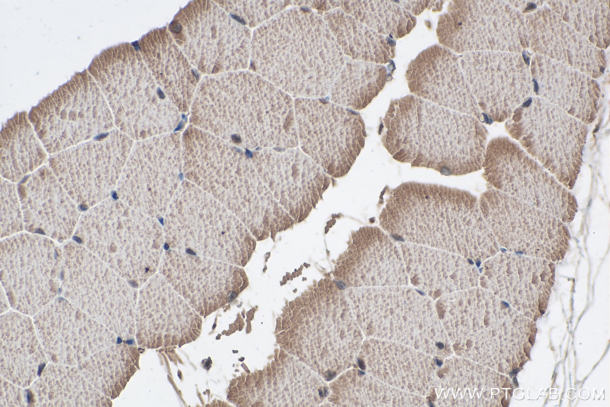 Immunohistochemical analysis of paraffin-embedded mouse skeletal muscle tissue slide using KHC0318 (CAPN3 IHC Kit).