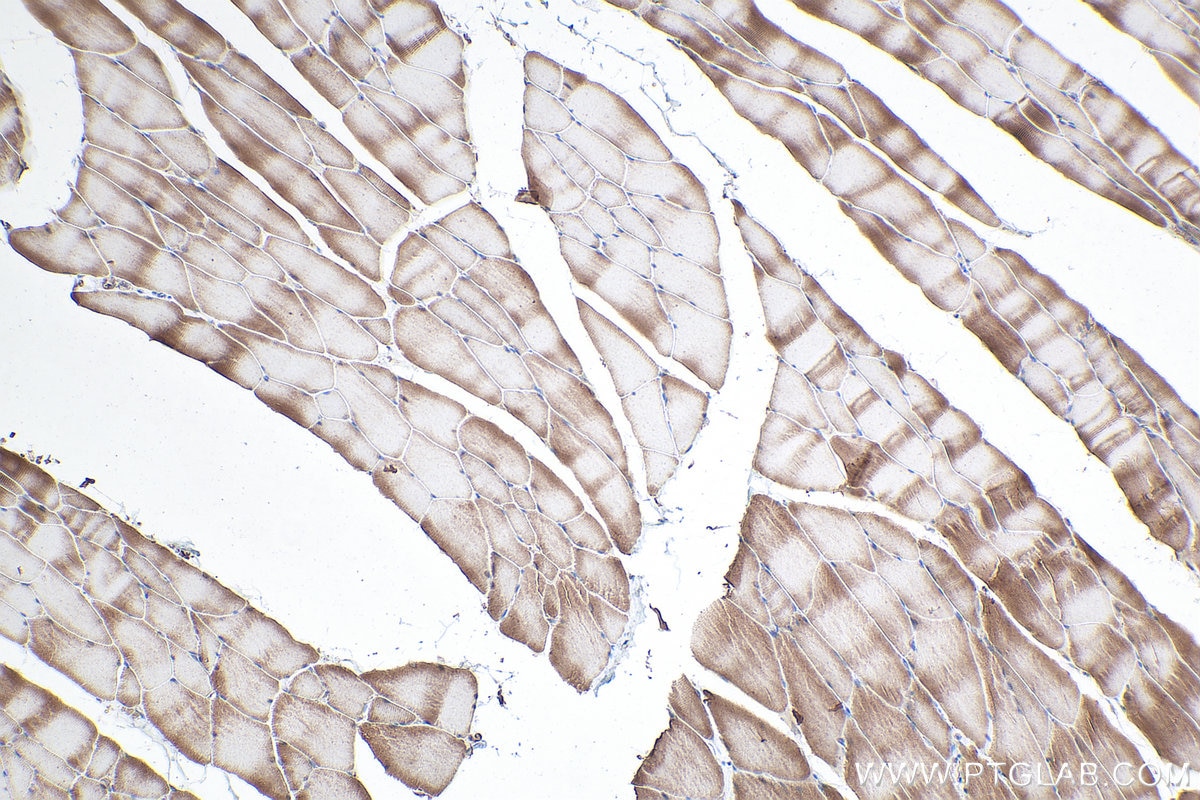 Immunohistochemical analysis of paraffin-embedded rat skeletal muscle tissue slide using KHC0318 (CAPN3 IHC Kit).