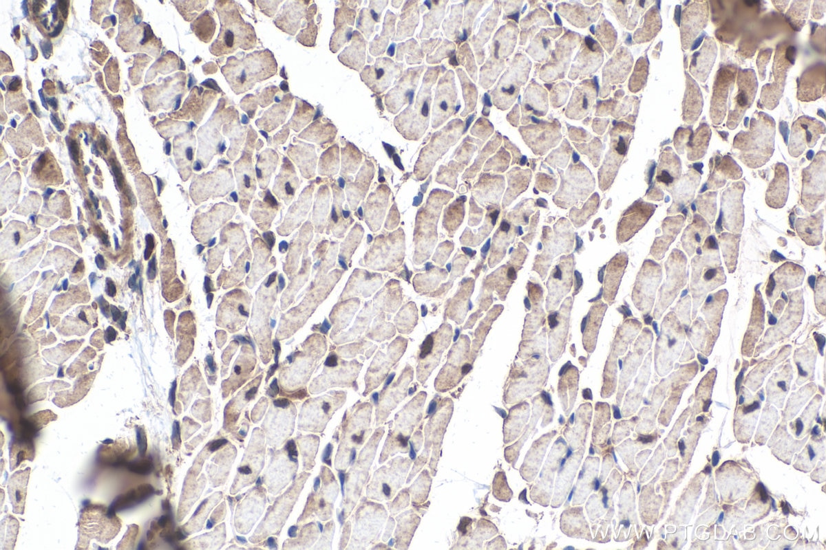 Immunohistochemical analysis of paraffin-embedded mouse heart tissue slide using KHC0323 (CAPN3 IHC Kit).