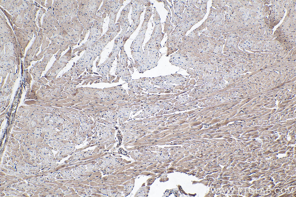 Immunohistochemical analysis of paraffin-embedded rat heart tissue slide using KHC0323 (CAPN3 IHC Kit).