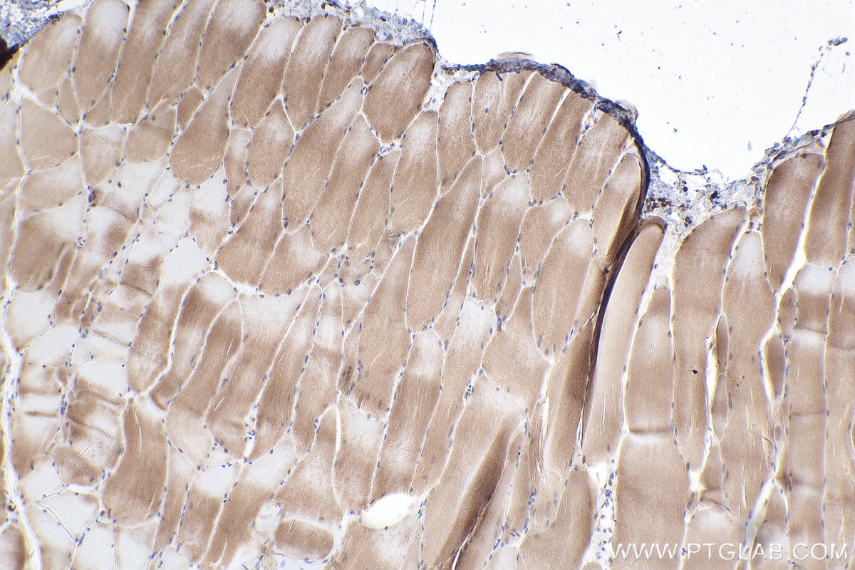 Immunohistochemical analysis of paraffin-embedded rat skeletal muscle tissue slide using KHC0323 (CAPN3 IHC Kit).