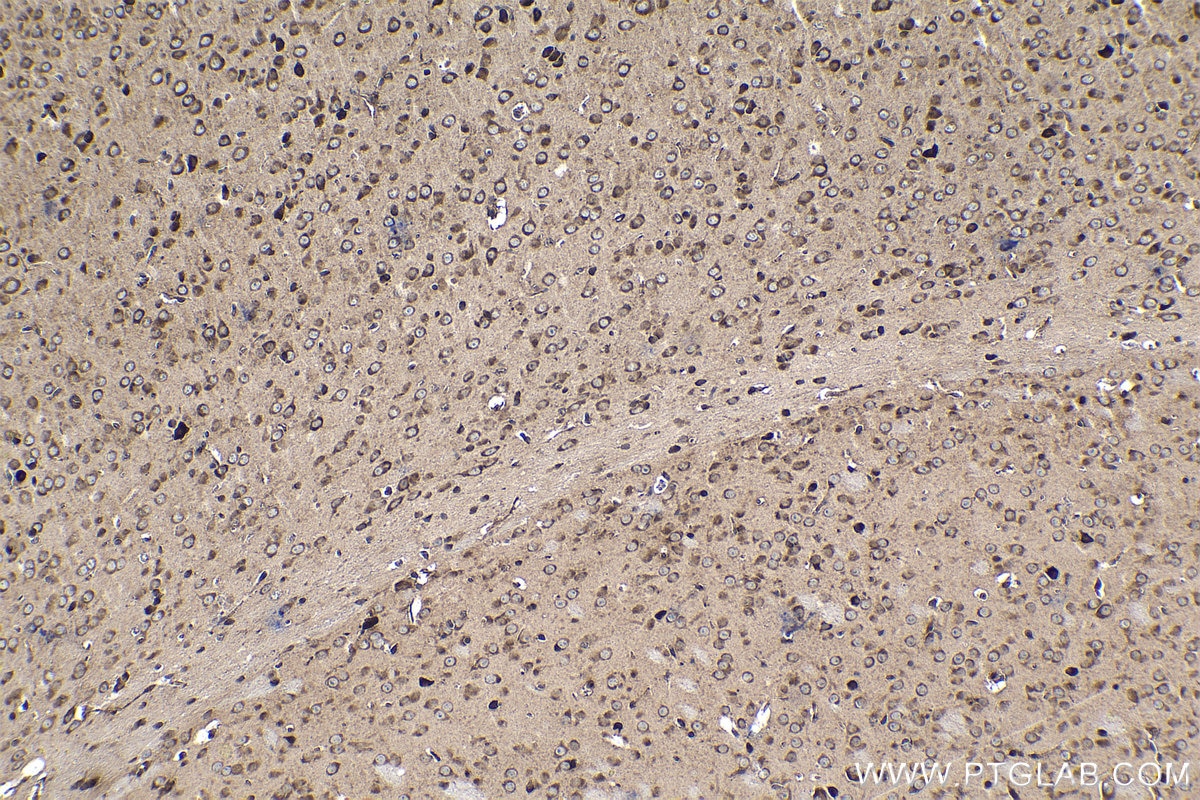 Immunohistochemical analysis of paraffin-embedded mouse brain tissue slide using KHC1395 (CAPRIN1 IHC Kit).