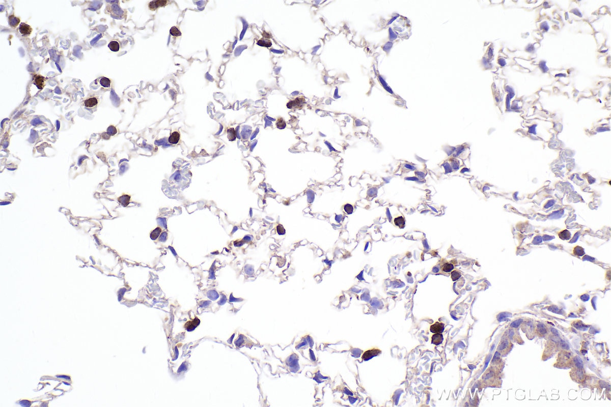 Immunohistochemical analysis of paraffin-embedded mouse lung tissue slide using KHC2313 (CAPZA1 IHC Kit).