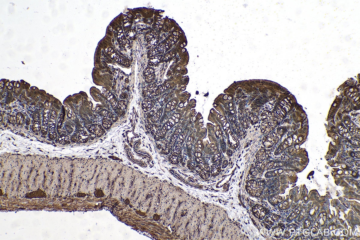 Immunohistochemical analysis of paraffin-embedded rat colon tissue slide using KHC0707 (CAPZB IHC Kit).