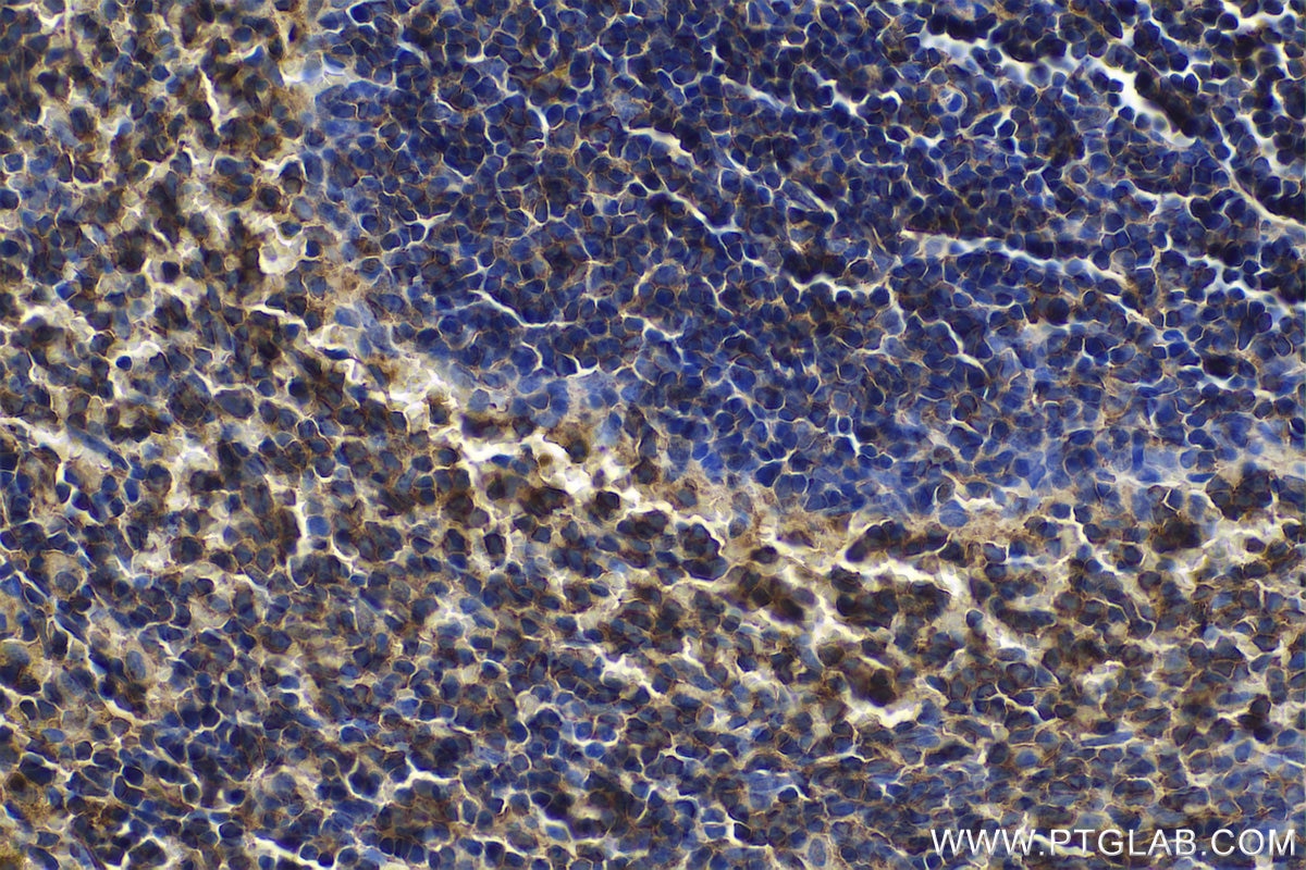 Immunohistochemical analysis of paraffin-embedded rat spleen tissue slide using KHC0707 (CAPZB IHC Kit).