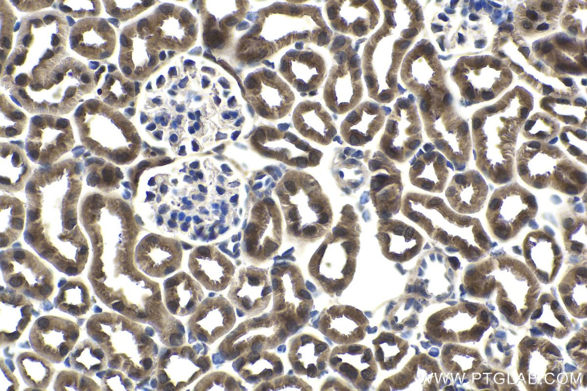 Immunohistochemical analysis of paraffin-embedded mouse kidney tissue slide using KHC1810 (CARM1 IHC Kit).