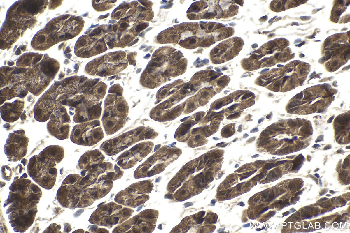 Immunohistochemical analysis of paraffin-embedded mouse stomach tissue slide using KHC1810 (CARM1 IHC Kit).