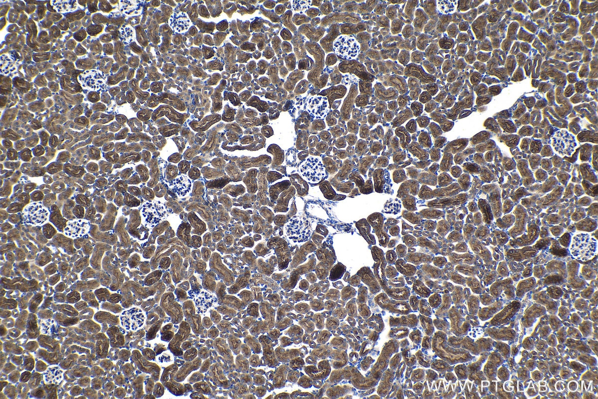 Immunohistochemical analysis of paraffin-embedded mouse kidney tissue slide using KHC1433 (CASK IHC Kit).