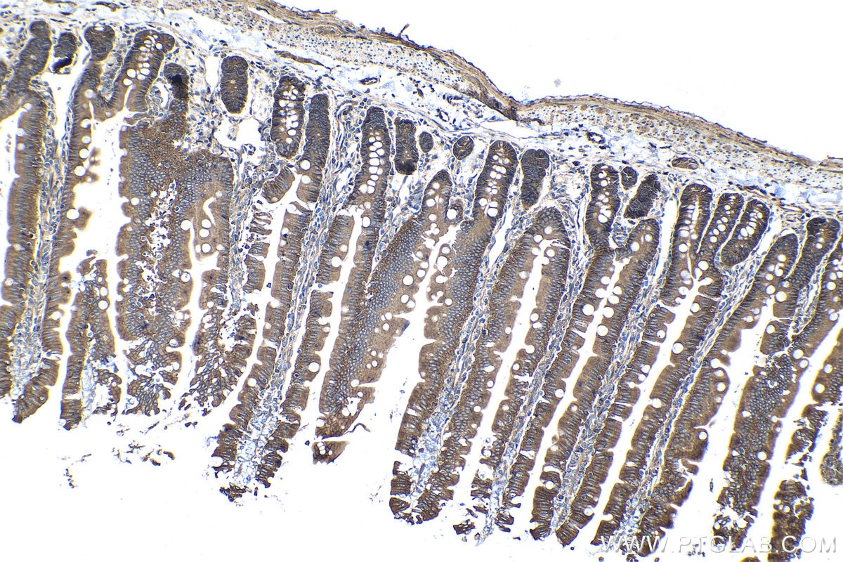 Immunohistochemical analysis of paraffin-embedded rat small intestine tissue slide using KHC1433 (CASK IHC Kit).