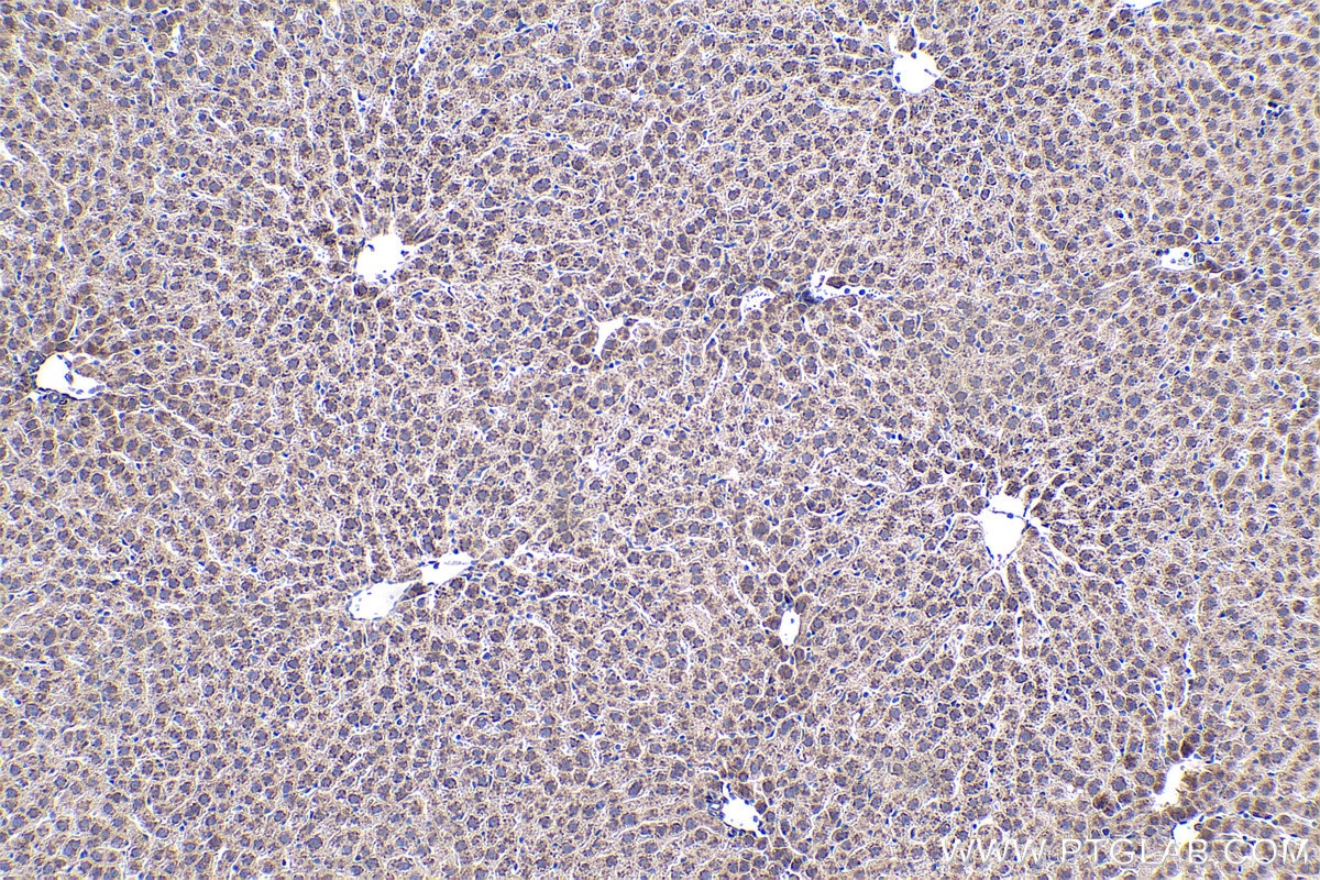 Immunohistochemical analysis of paraffin-embedded rat liver tissue slide using KHC0406 (CASP7 IHC Kit).