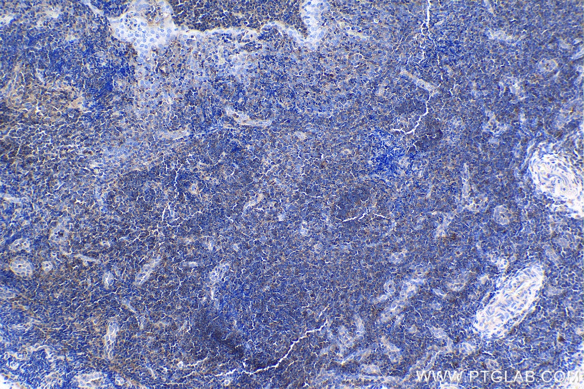 Immunohistochemical analysis of paraffin-embedded human tonsillitis tissue slide using KHC1050 (CBL IHC Kit).