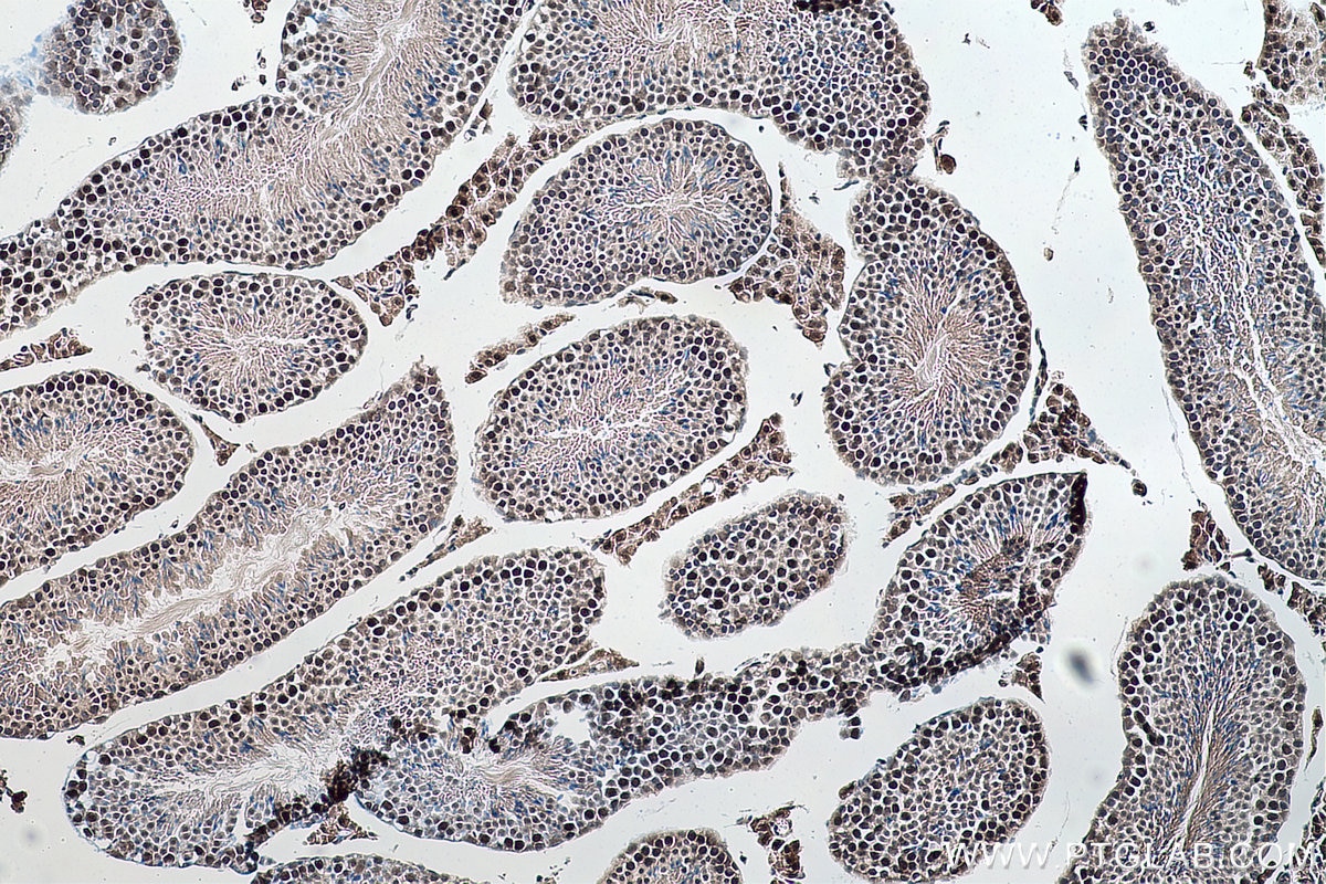 Immunohistochemical analysis of paraffin-embedded mouse testis tissue slide using KHC0152 (CBLL1 IHC Kit).