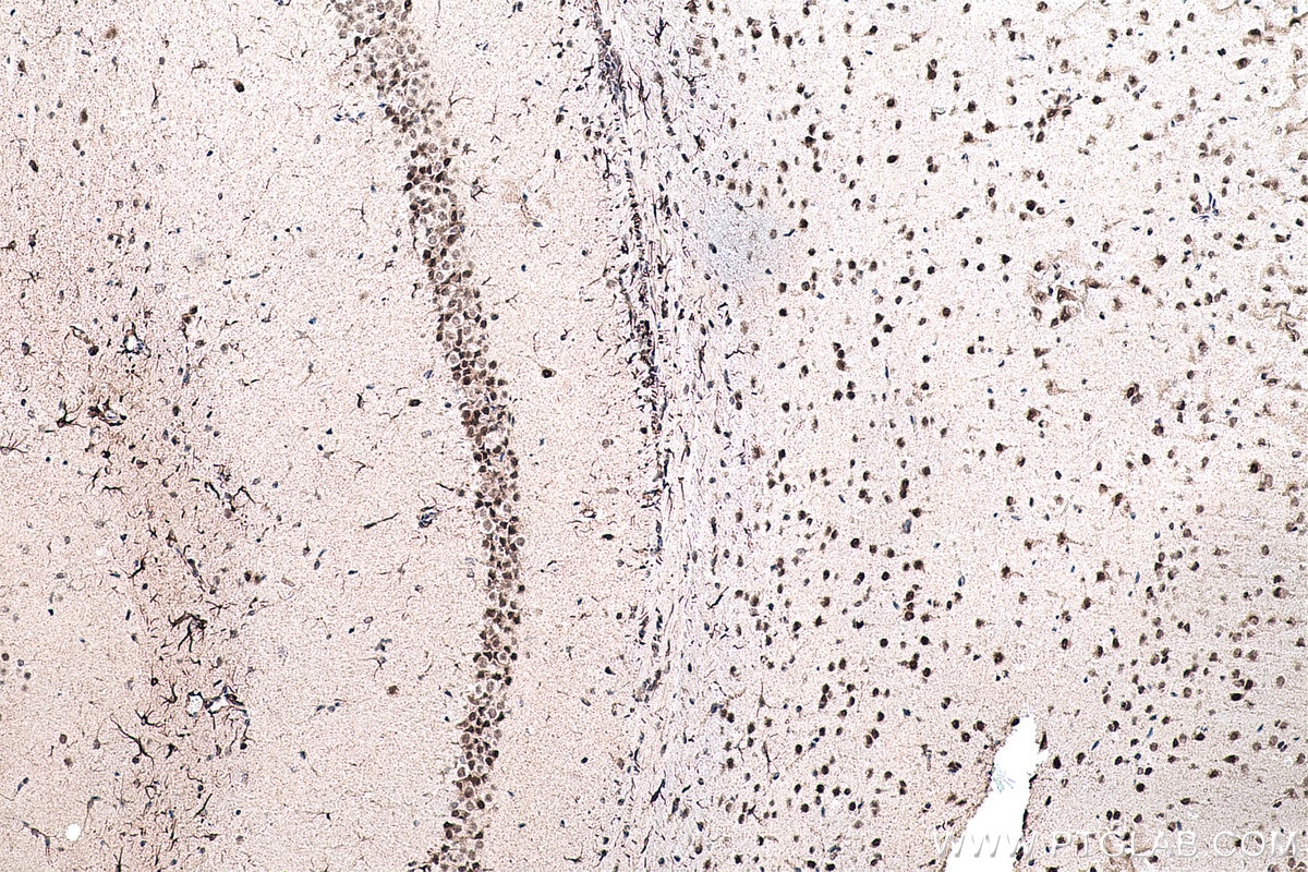 Immunohistochemical analysis of paraffin-embedded mouse brain tissue slide using KHC0152 (CBLL1 IHC Kit).