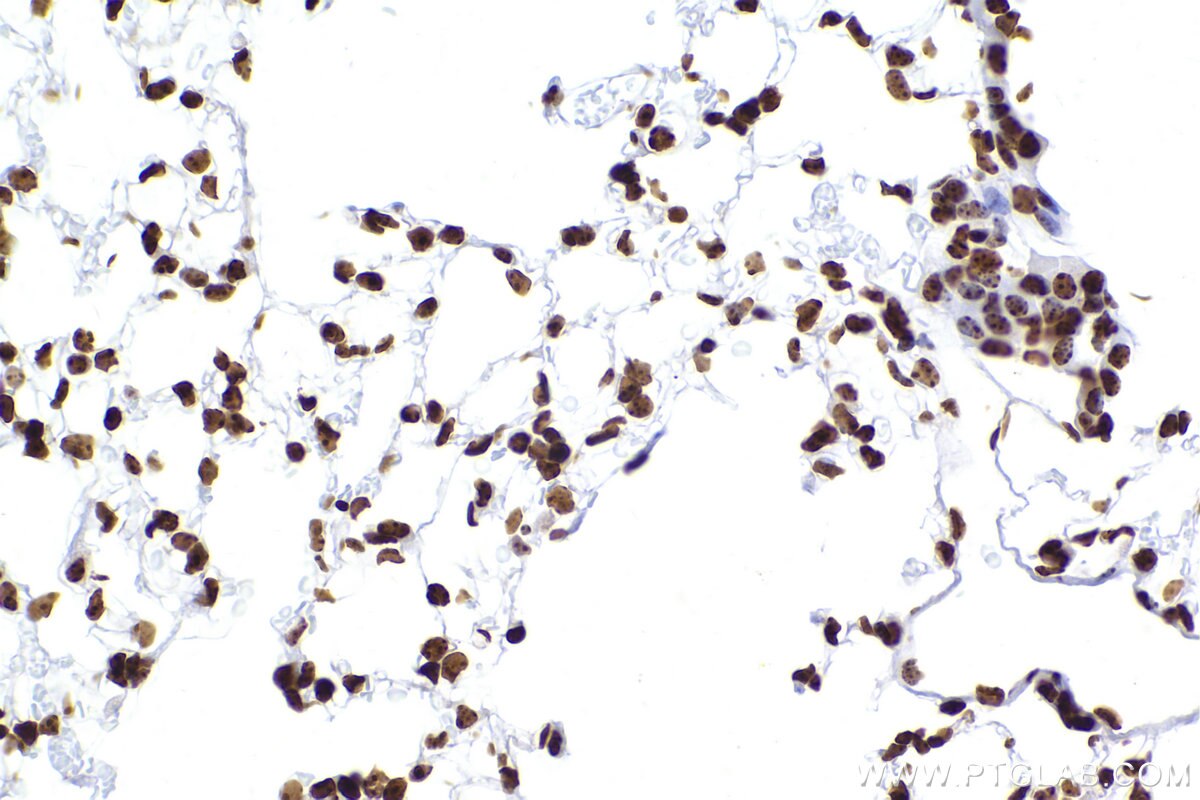 Immunohistochemical analysis of paraffin-embedded mouse lung tissue slide using KHC2421 (CBX3 IHC Kit).